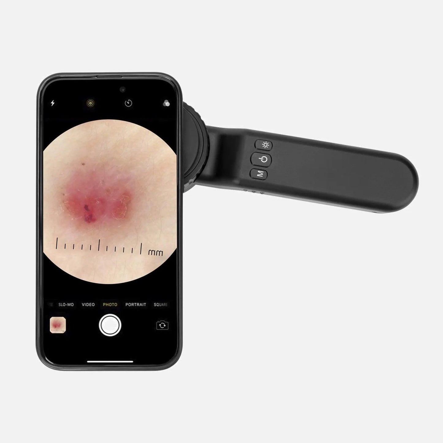 Magnetic Ring Adapter for Dermatoscope DE-4100 - IBOOLO DERMATOSCOPE