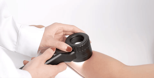 The IBOOLO dermoscope is the best hand-held dermoscope in the world - IBOOLO DERMATOSCOPE