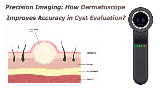 Precision Imaging: How Dermatoscope Improves Accuracy in Cyst Evaluation?