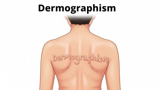Can Dermatoscope Detect Dermographism?