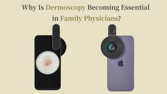 Why Is Dermoscopy Becoming Essential in Family Physicians?
