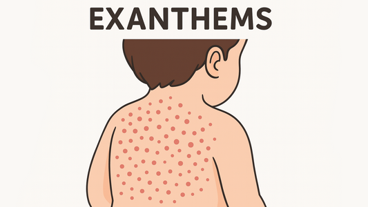 Can Dermatoscope Detect Exanthem?