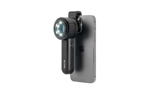 Can Dermatoscope Detect Wart?