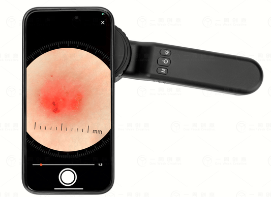 How to use a dermatoscope? - IBOOLO DERMATOSCOPE