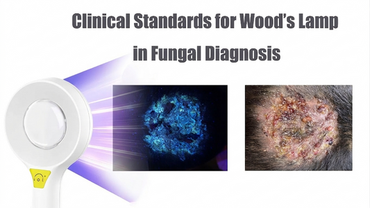What Are the Clinical Standards for Wood’s Lamp in Fungal Diagnosis?