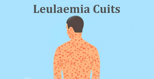 Can Dermatoscope Detect Leukaemia Cutis?