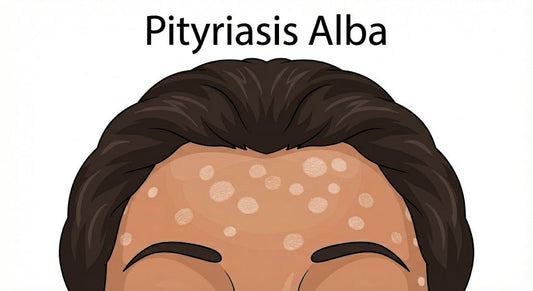 Can Dermatoscope Detect Pityriasis Alba?