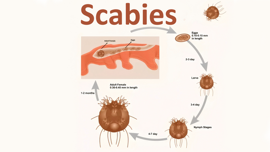 Can Dermatoscope Detect Scabies?