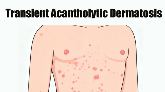 Can Dermatoscope Detect Transient Acantholytic Dermatosis?