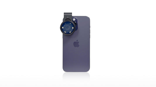 Can Dermatoscope Detect Lichenoid Keratosis?