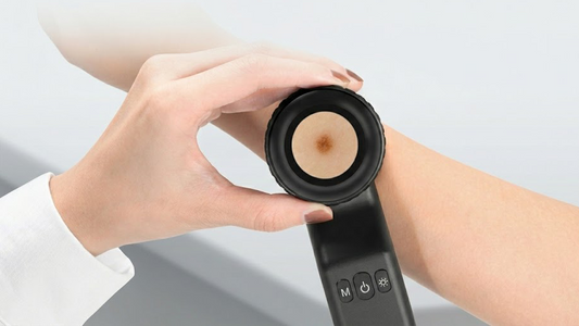 Why is Optical Fidelity the True Gold Standard in Dermoscopy?