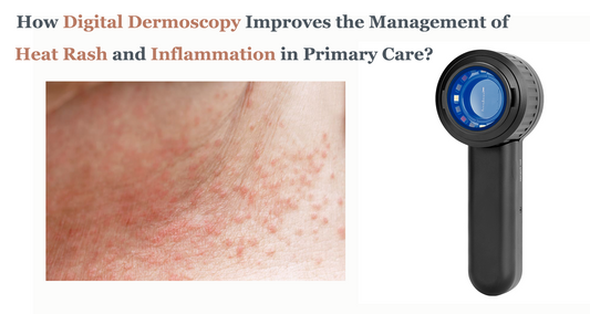 Beyond the Naked Eye: How Digital Dermoscopy Improves the Management of Heat Rash and Inflammation in Primary Care
