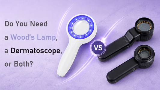 Do You Need a Wood’s Lamp, a Dermatoscope, or Both?