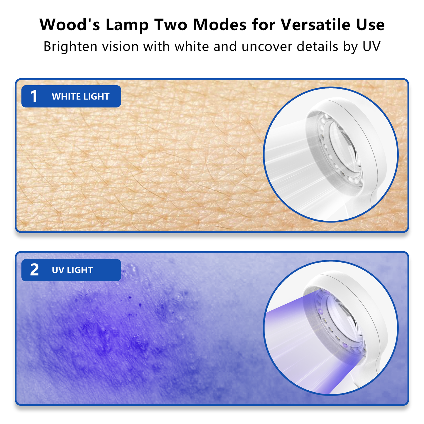 IBOOLO DE-215 Handheld wood's lamp skin analyzer scanner with 365nm UV Fluorescent light - IBOOLO DERMATOSCOPE