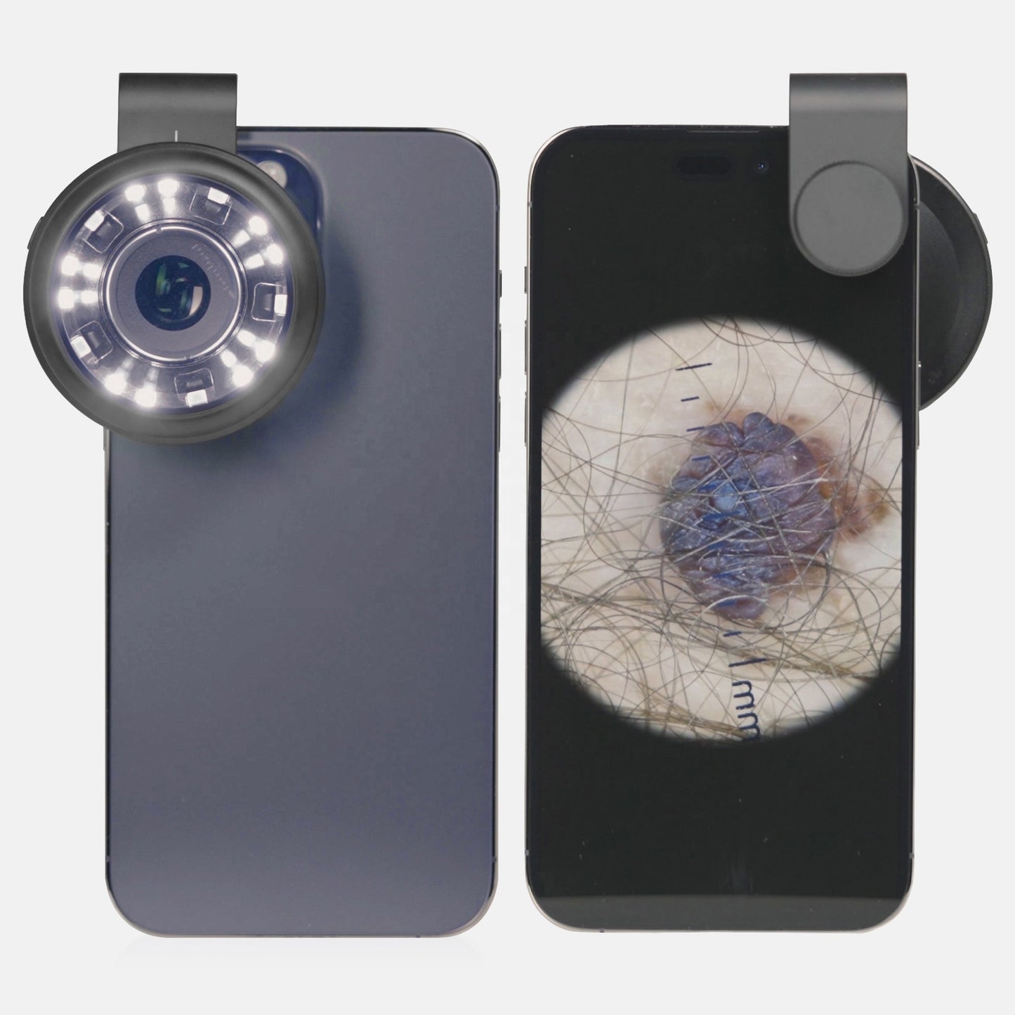 IBOOLO DE-400 Pocket Hybrid Dermatoscope With Aapter for Smartphones