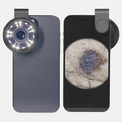 IBOOLO DE-400 Pocket Hybrid Dermatoscope With Aapter for Smartphones