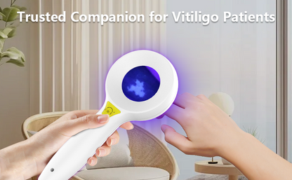 IBOOLO woods lamp DE-315 UV 365nm & UV405nm violet light dermoscopy wood's lamp veterinarian