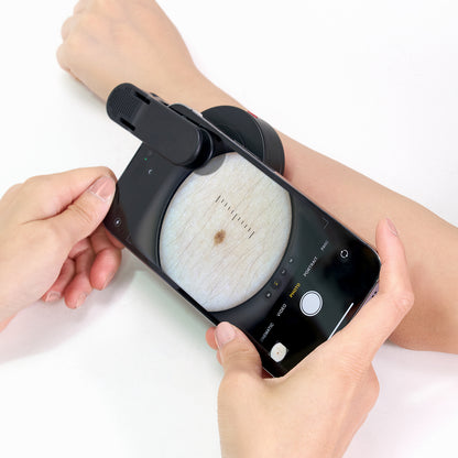 IBOOLO New Launch DE-500 Versatile Dermoscopy with Magnetic Ring Adapter