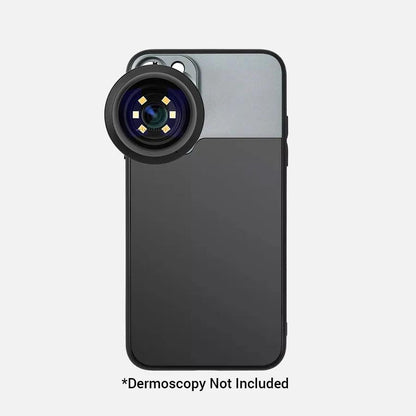 Case for Iphone – Compatible with Dermatoscope