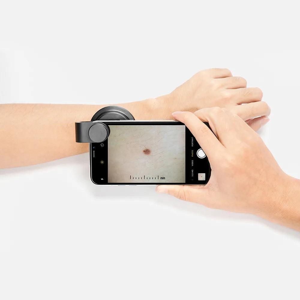 Smartphone Universal Lens Mount for Dermatoscope - IBOOLO DERMATOSCOPE